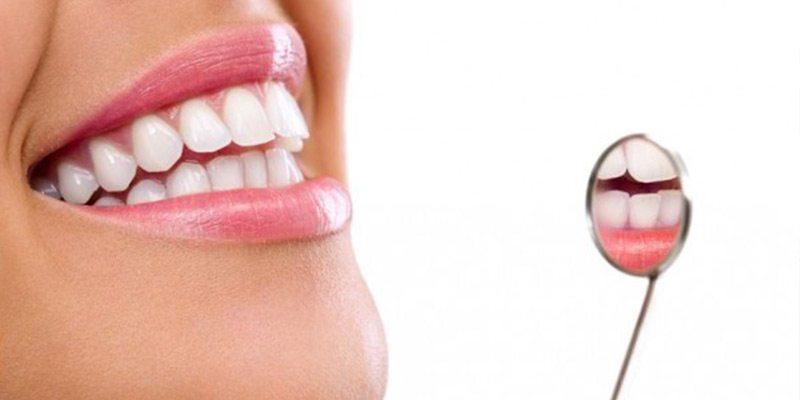Clareamento dos dentes: recuperando a beleza de seu sorriso