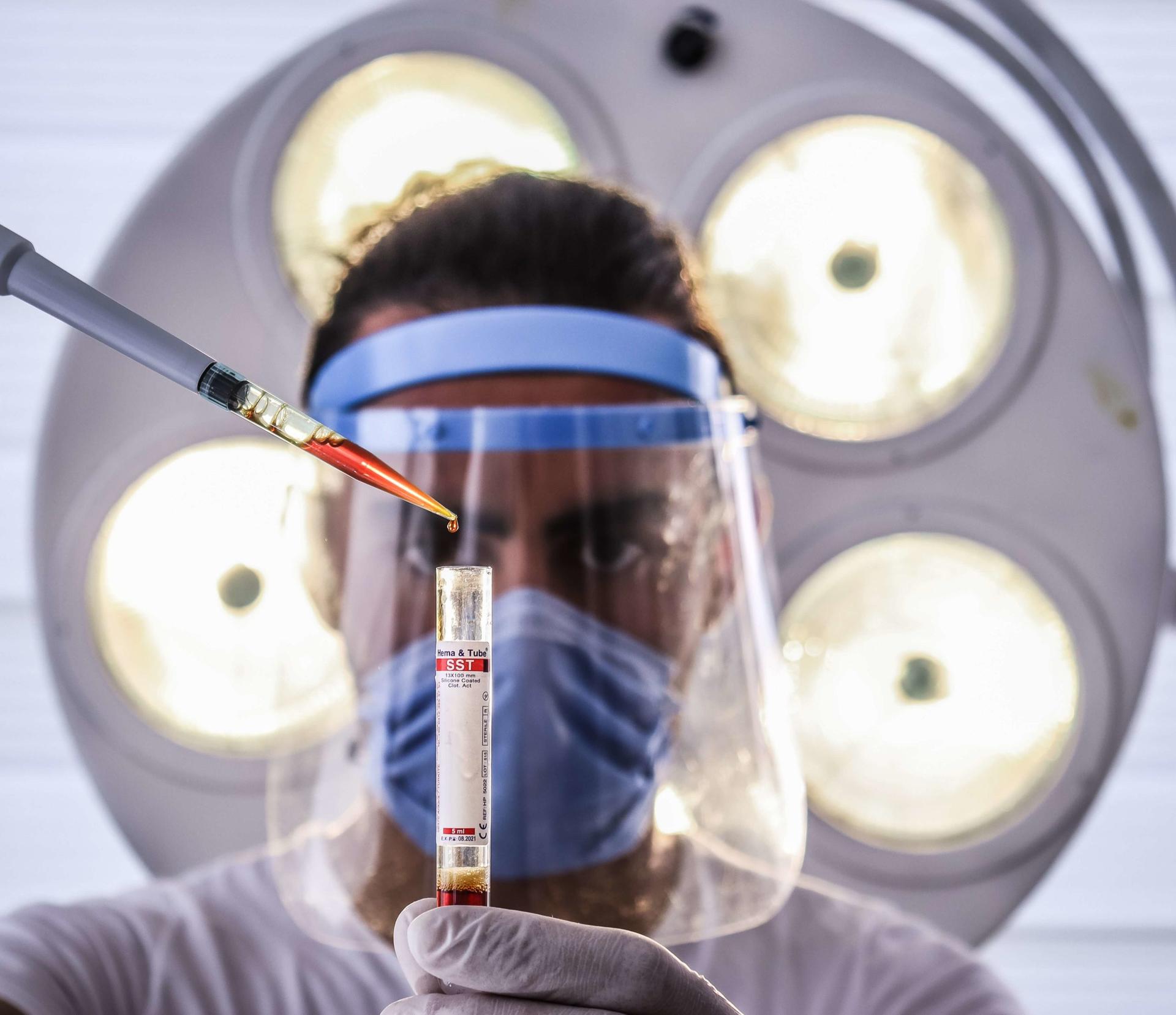 Hemoglobina Glicada: O Que É, Importância e Como Funciona