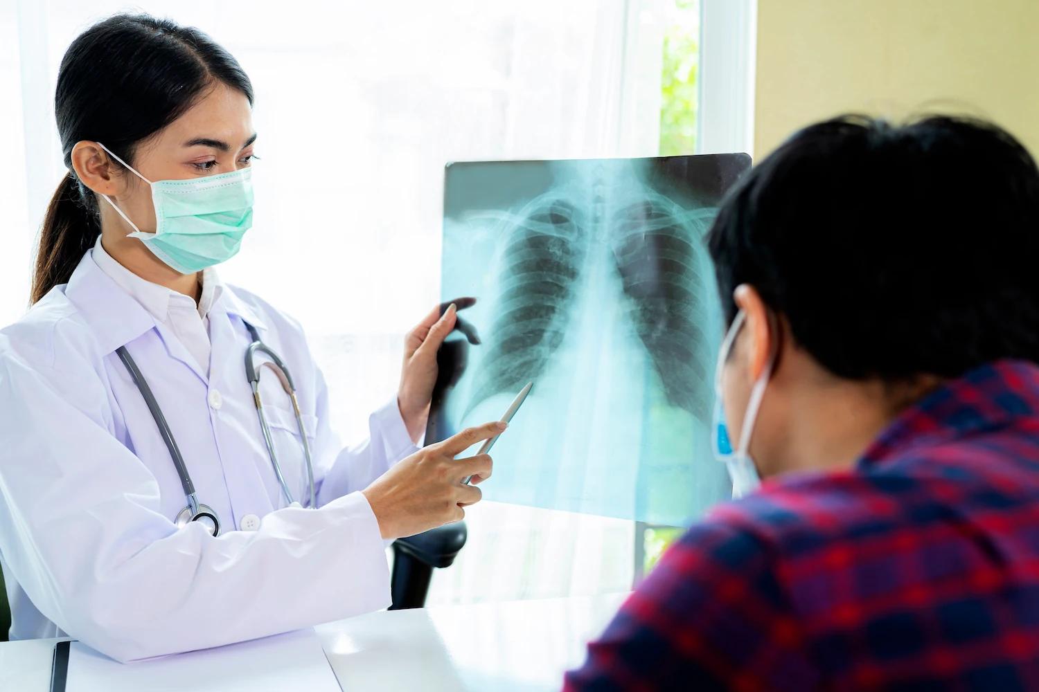 Pneumonia: Tipos, sintomas e tratamentos