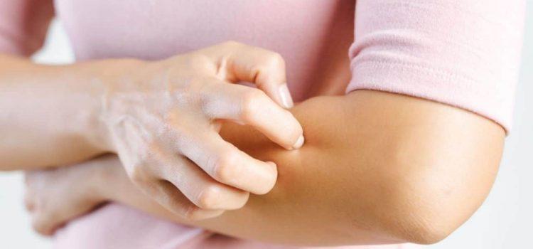 Coceira na pele é sempre alergia?
